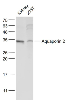 AQP2 Rabbit Polyclonal Antibody