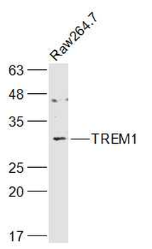 TREM1 Rabbit Polyclonal Antibody