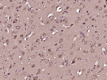 PER2 Rabbit Polyclonal Antibody