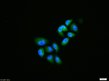 Nurr1 antibody