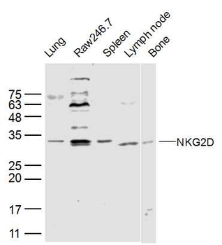 NKG2D Rabbit Polyclonal Antibody