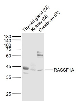 RASSF1A antibody