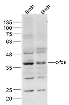 C-fos Rabbit Polyclonal Antibody