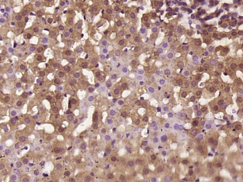 StAR Rabbit Polyclonal Antibody