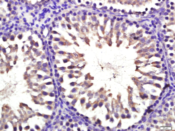CYP11B1 Rabbit Polyclonal Antibody