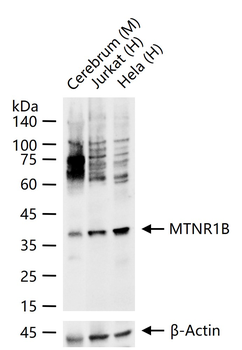 MTNR1B Rabbit Polyclonal Antibody