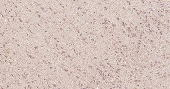 MTNR1B Rabbit Polyclonal Antibody