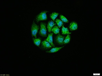 MTNR1B antibody