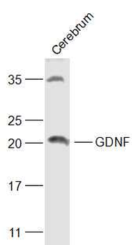 GDNF Rabbit Polyclonal Antibody