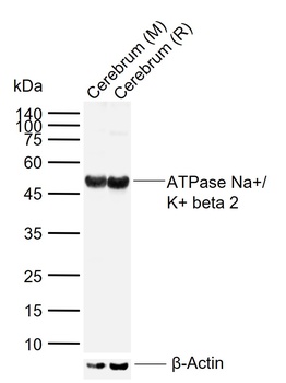 ATPase Na+ antibody
