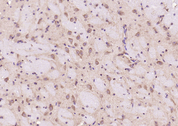STAT3 Mouse Monoclonal Antibody