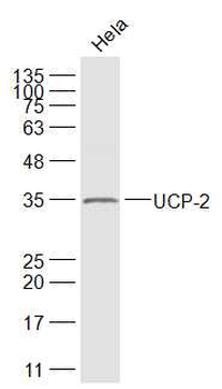 UCP-2 Rabbit Polyclonal Antibody