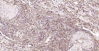DDIT3 Rabbit Polyclonal Antibody