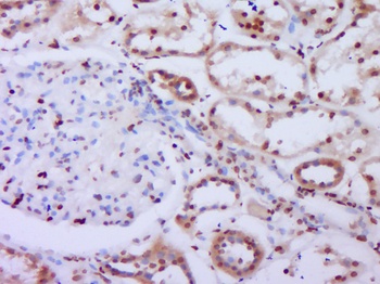 BRCA1 (phospho-Ser1466) antibody