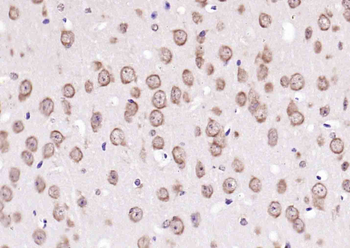 Anillin Rabbit Polyclonal Antibody