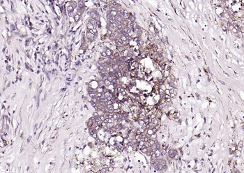 TGF beta Receptor II Rabbit Polyclonal Antibody