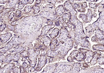TGF beta Receptor II Rabbit Polyclonal Antibody