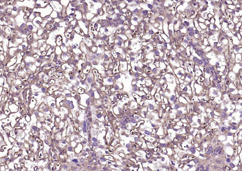 TGF beta Receptor II Rabbit Polyclonal Antibody
