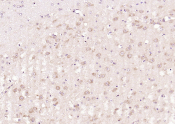 Nrf2 Rabbit Polyclonal Antibody
