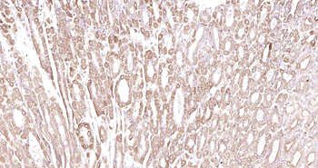 LRCH1 Rabbit Polyclonal Antibody