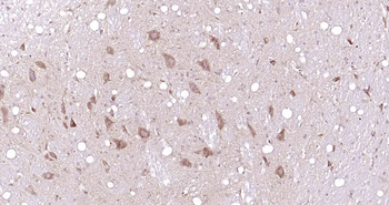 LRCH1 Rabbit Polyclonal Antibody
