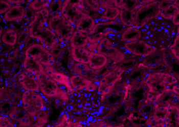VEGFA Rabbit Polyclonal Antibody