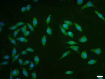 Cyclin D1 Rabbit Polyclonal Antibody