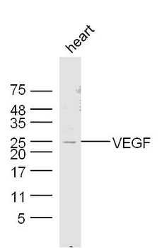 VEGFA Rabbit Polyclonal Antibody