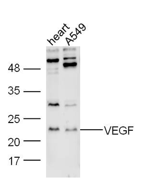 VEGFA Rabbit Polyclonal Antibody