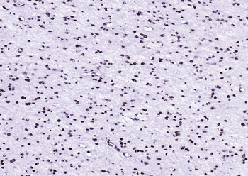 Histone H3 Mouse Monoclonal Antibody (Nuclear Loading Control)