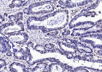 GAPDH Rabbit Polyclonal Antibody (Loading Control)