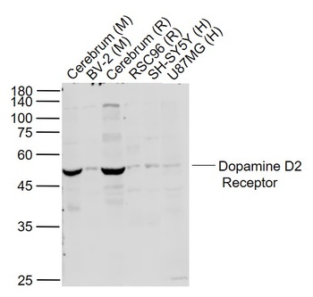 Dopamine D2 receptor antibody