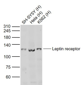 Leptin receptor Rabbit Polyclonal Antibody