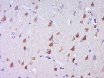 C-Kit/CD117 Rabbit Polyclonal Antibody