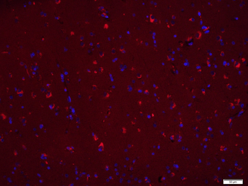 Bax Mouse Monoclonal Antibody