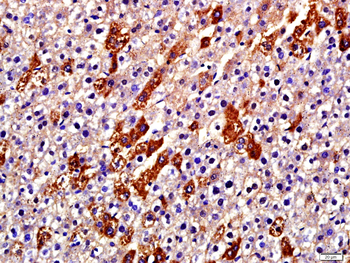 Collagen alpha-1 (I) chain Rabbit Polyclonal Antibody