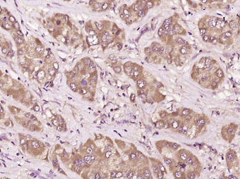 NALP3/CIAS1 Rabbit Polyclonal Antibody