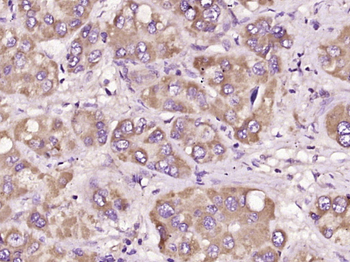 NALP3/CIAS1 Rabbit Polyclonal Antibody