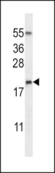 Ribonuclease 3/ECP Rabbit Polyclonal Antibody