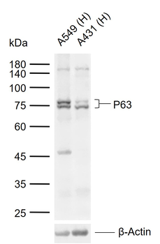 P63 Mouse Monoclonal Antibody