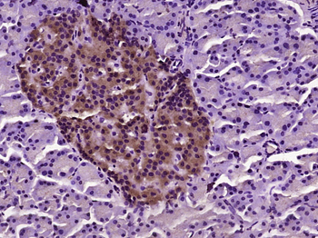 MUC5B Rabbit Polyclonal Antibody