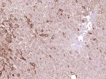 TTR/Prealbumin Mouse Monoclonal Antibody