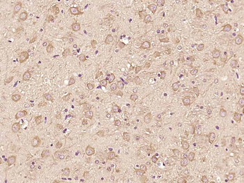 ATF6 Rabbit Polyclonal Antibody