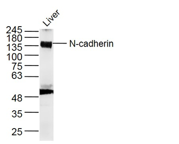 N-cadherin Rabbit Polyclonal Antibody