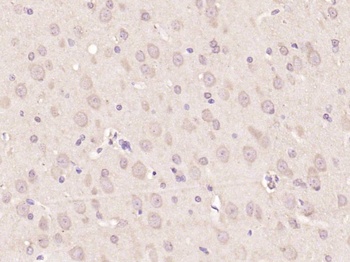 Nestin antibody