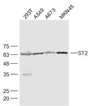 ST2 Rabbit Polyclonal Antibody