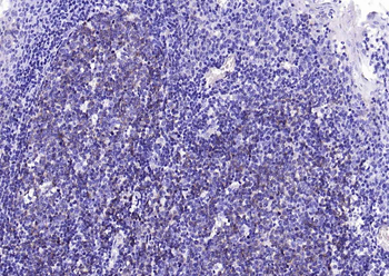 NFKB p65 Mouse Monoclonal Antibody