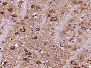 DRD2 Rabbit Polyclonal Antibody