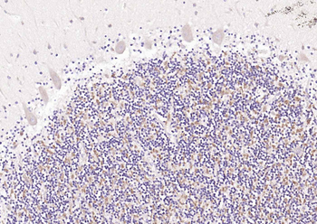PGP9.5 Rabbit Polyclonal Antibody