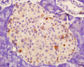 CD62p Rabbit Polyclonal Antibody